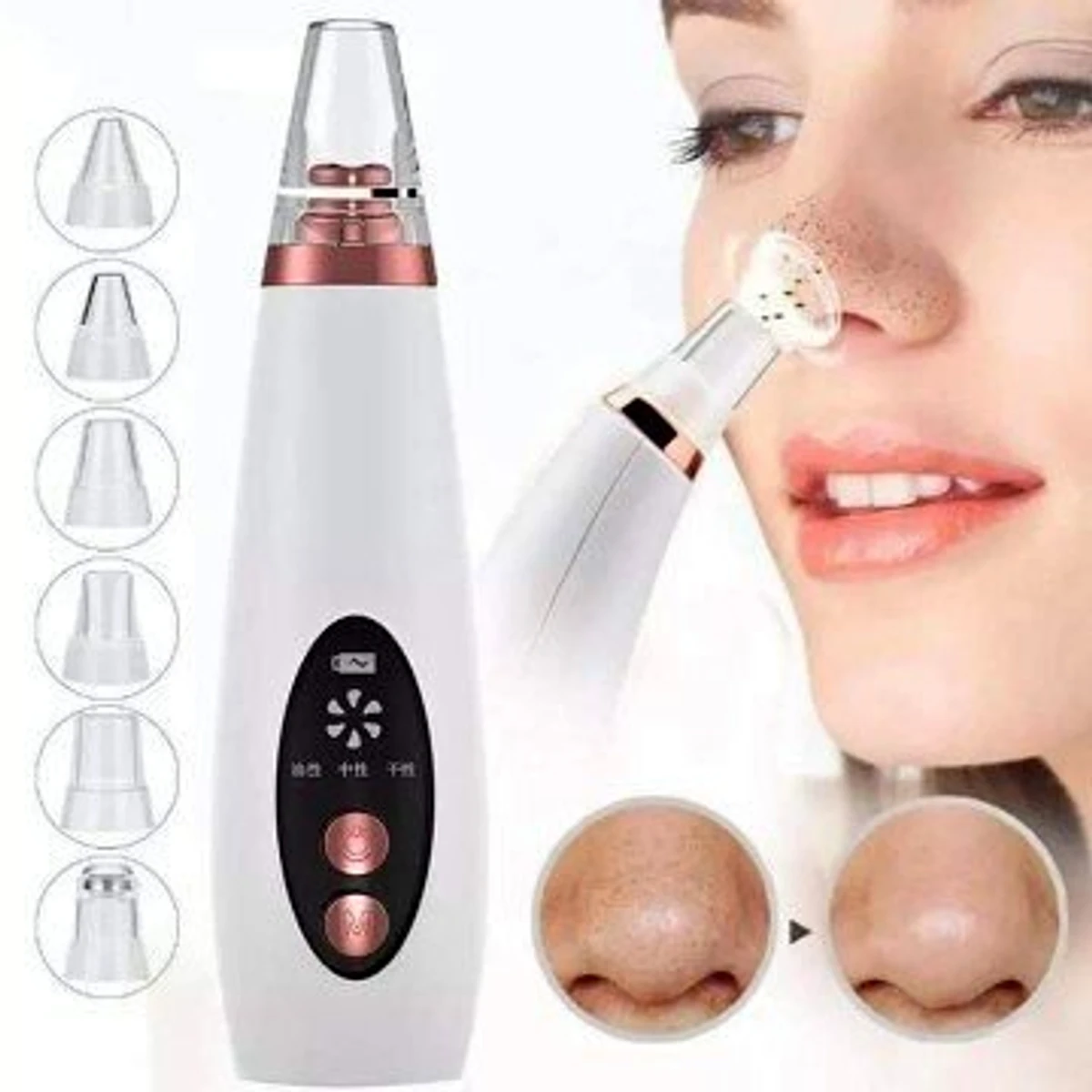 blackhead Remover