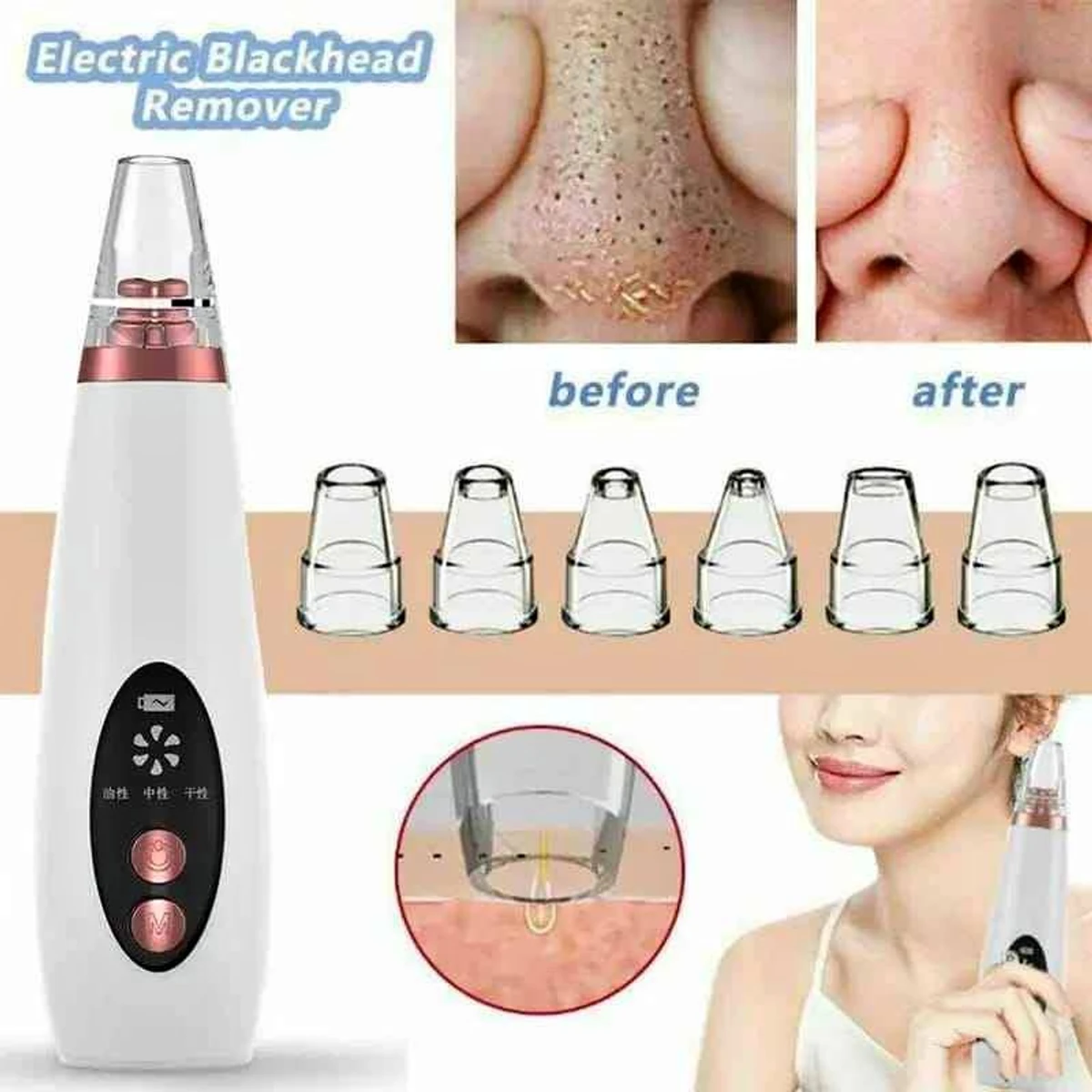 blackhead Remover - Image 5